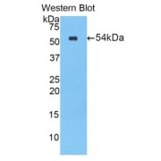 Western blot analysis of the recombinant protein.