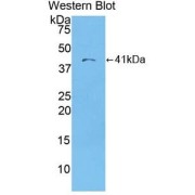 Western blot analysis of the recombinant protein.