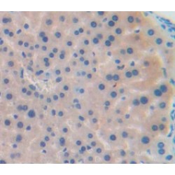 Macrophage Derived Chemokine (MDC) Antibody