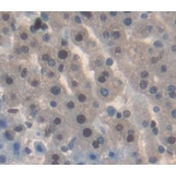 Paraneoplastic Antigen MA2 (PNMA2) Antibody