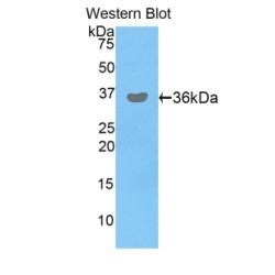 Pyruvate Dehydrogenase Beta (PDHb) Antibody