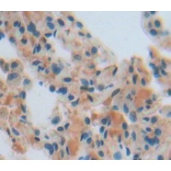 Pyruvate Dehydrogenase Beta (PDHb) Antibody