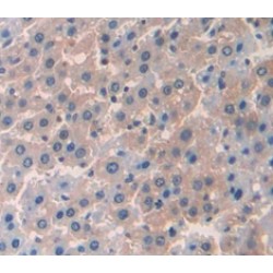 Tumor Necrosis Factor (TNF) Antibody