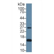 Western blot analysis of Human HeLa cell lysate, using Human AQP2 Antibody (1 µg/ml) and HRP-conjugated Goat Anti-Rabbit antibody (<a href="https://www.abbexa.com/index.php?route=product/search&amp;search=abx400043" target="_blank">abx400043</a>, 0.2 µg/ml).