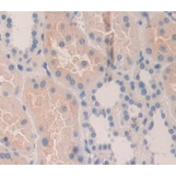 Aquaporin 2 (AQP2) Antibody