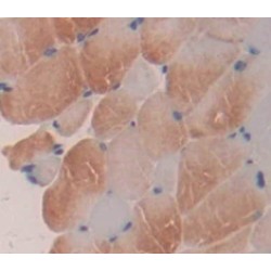 Polyunsaturated Fatty Acid 5-Lipoxygenase (ALOX5) Antibody