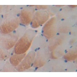 Polyunsaturated Fatty Acid 5-Lipoxygenase (ALOX5) Antibody