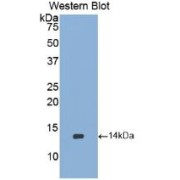 Western blot analysis of the recombinant protein.