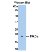 Western blot analysis of the recombinant protein.