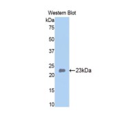 Western blot analysis of the recombinant protein.