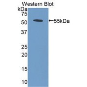 Western blot analysis of the recombinant protein.