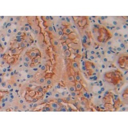 Bone Morphogenetic Protein 5 (BMP5) Antibody