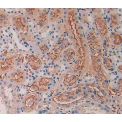 Bone Morphogenetic Protein 5 (BMP5) Antibody