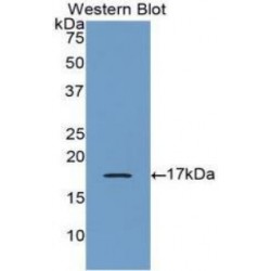 Bone Morphogenetic Protein 6 (BMP6) Antibody