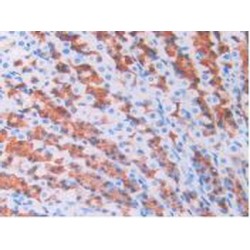 Bone Morphogenetic Protein 6 (BMP6) Antibody