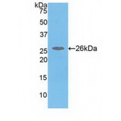 Catechol-O-Methyltransferase (COMT) Antibody