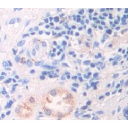 Collagen Type VIII Alpha 2 (COL8A2) Antibody