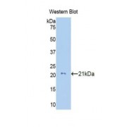 Western blot analysis of the recombinant protein.