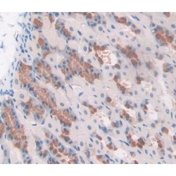 Collagen Type VIII Alpha 2 (COL8A2) Antibody