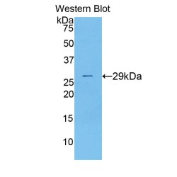 Dihydrolipoyl Transacetylase (DLAT) Antibody