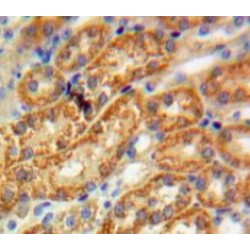 Tissue Alpha-L-Fucosidase (FUCA1) Antibody