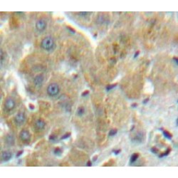 Tissue Alpha-L-Fucosidase (FUCA1) Antibody