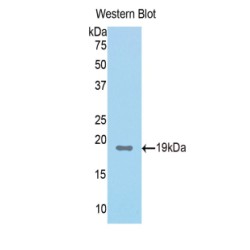 Fumarylacetoacetate Hydrolase (FAH) Antibody