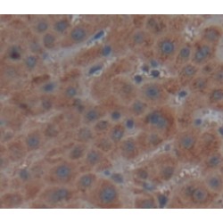 Fumarylacetoacetate Hydrolase (FAH) Antibody