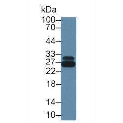 Glutathione S Transferase Pi (GSTp) Antibody