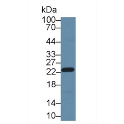 Glutathione S Transferase Pi (GSTp) Antibody