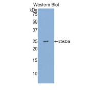 Western blot analysis of recombinant Human GSTp.