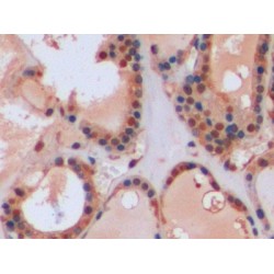 Glutathione S Transferase Pi (GSTp) Antibody