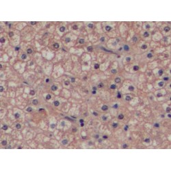 Glutathione S Transferase Pi (GSTp) Antibody