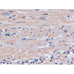 Glutathione S Transferase Pi (GSTp) Antibody