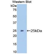 Western blot analysis of the recombinant protein.