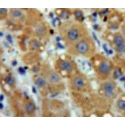 Glutathione S Transferase Pi (GSTp) Antibody