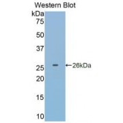 Western blot analysis of recombinant Human GSTp.