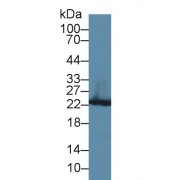 Western blot analysis of Rat Liver lysate, using Rat GSTp Antibody (3 µg/ml) and HRP-conjugated Goat Anti-Rabbit antibody (<a href="https://www.abbexa.com/index.php?route=product/search&amp;search=abx400043" target="_blank">abx400043</a>, 0.2 µg/ml).