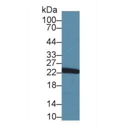 Glutathione S Transferase Pi (GSTp) Antibody