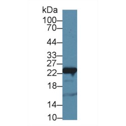 Glutathione S Transferase Pi (GSTp) Antibody