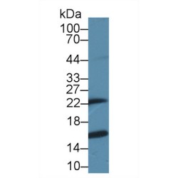 Glutathione S Transferase Pi (GSTp) Antibody