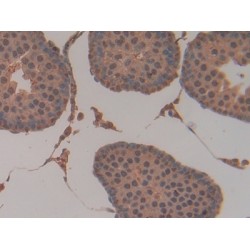 Glutathione S Transferase Pi (GSTp) Antibody