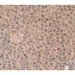 Glutathione S Transferase Pi (GSTp) Antibody