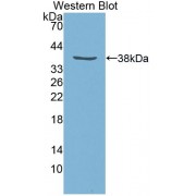 Western blot analysis of the recombinant protein.