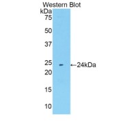 Western blot analysis of the recombinant protein.