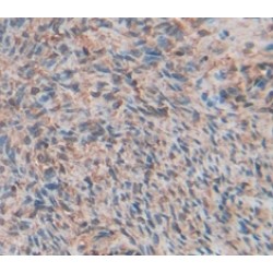 Matrix Metalloproteinase 11 (MMP11) Antibody