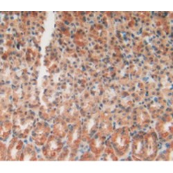 Matrix Metalloproteinase 12 (MMP12) Antibody