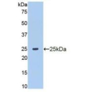 Western blot analysis of recombinant Human MMP13.