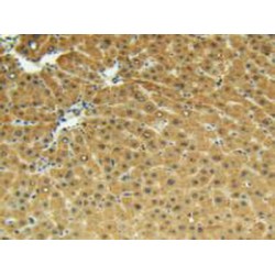 Matrix Metalloproteinase 13 (MMP13) Antibody