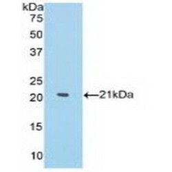 Matrix Metalloproteinase 13 (MMP13) Antibody